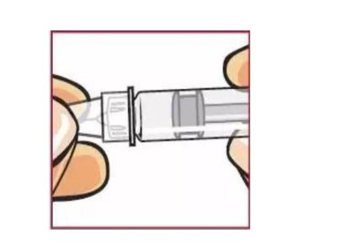 深圳助孕试管供卵代怀:孕妇宫腔粘连要小心,严重可致胎儿停育